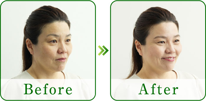 before/after
